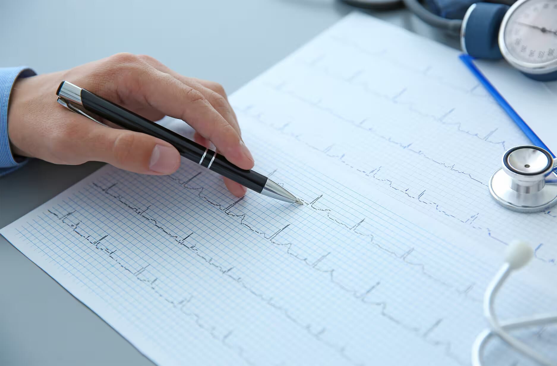 Electrocardiograma (ECG)